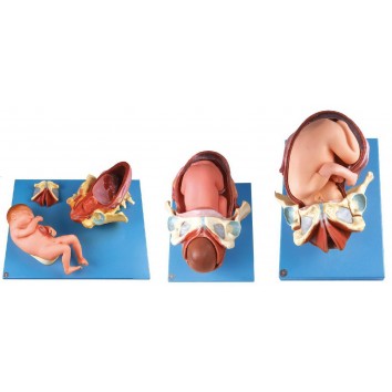 DEMONSTRATION  MODEL OF CHILDBIRTH (SOFT)